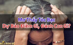 Nam-Mo-Thay-Toc-Bac-Danh-Con-Gi-Du-Bao-Diem-Gi