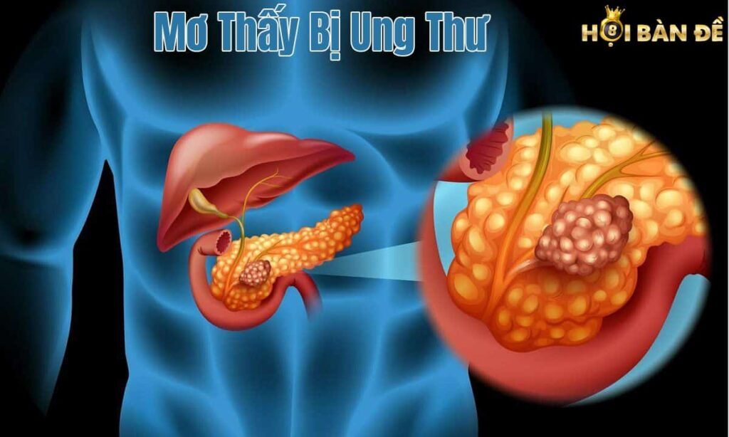 Mơ Thấy Bị Ung Thư Đánh Con Gì? Có Đáng Lo Sợ?